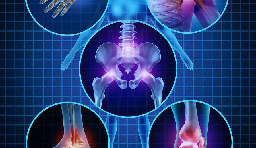 Cannabis and Musculoskeletal Issues:  Why It’s a Viable Alternative to Traditional Meds