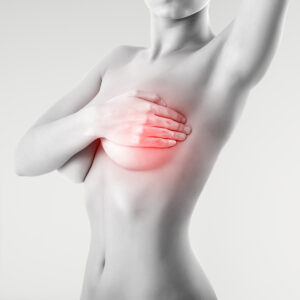 Naturopathic Remedies for Breast Cancer