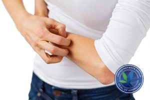 Does Cannabis Cause Itchiness or Cure It?
