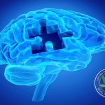Parkinson's and Dementia Brain Image